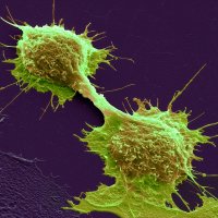 Hlavní obrázek - Holografická mikroskopie odhalí invazivitu nádorů