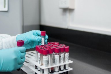 Hlavní obrázek - České i zahraniční novinky v léčbě a výzkumu chronické myeloidní leukemie